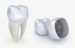 What to Expect When Getting a Dental Crown